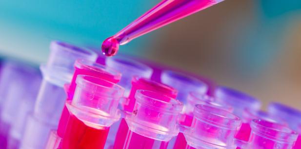 Roze vloeistof in buisjes onderzoek borstkanker